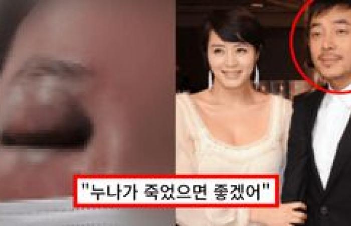 “Indiscriminate assault until you lose your mind” Kim Hye-soo revealed the shocking reason for losing her younger brother